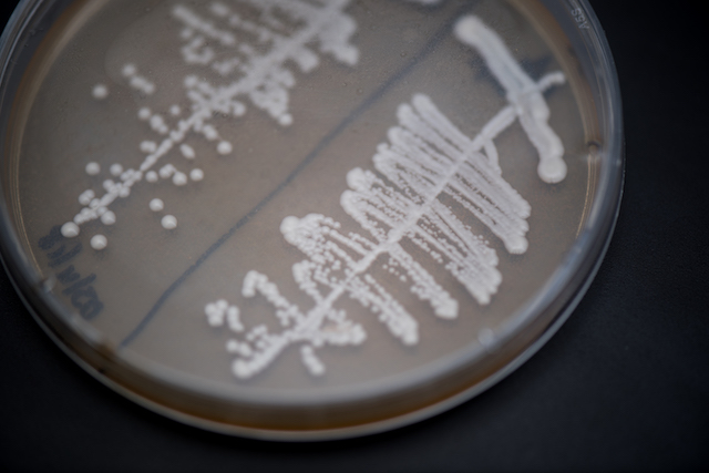 This wild yeast was cultivated from a North Fork beach plum. (Credit: David Benthal)